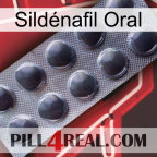 Sildénafil Oral 30